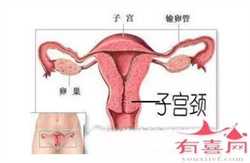 上海合法助孕花多少钱,选择适合自己的助孕方式，让泰国试管婴儿少花钱